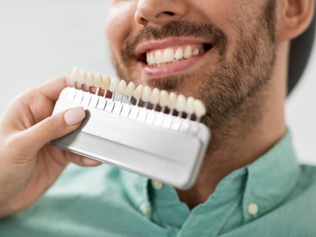 Veneers in Turkey: The Best Option to Get Your Perfect Smile